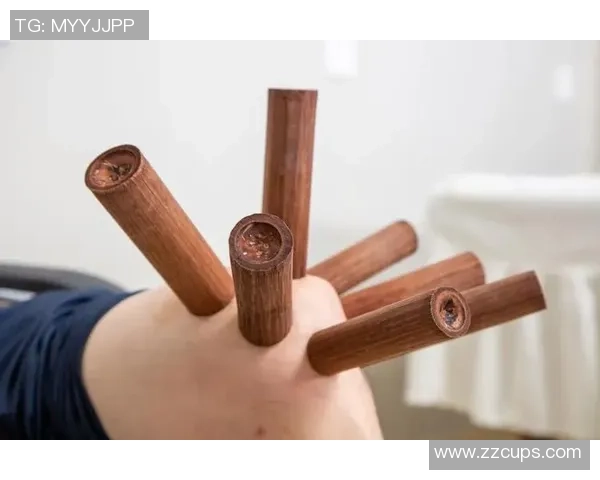 足球明星拔火罐疗法引热议 是否真的能提升运动表现与恢复速度